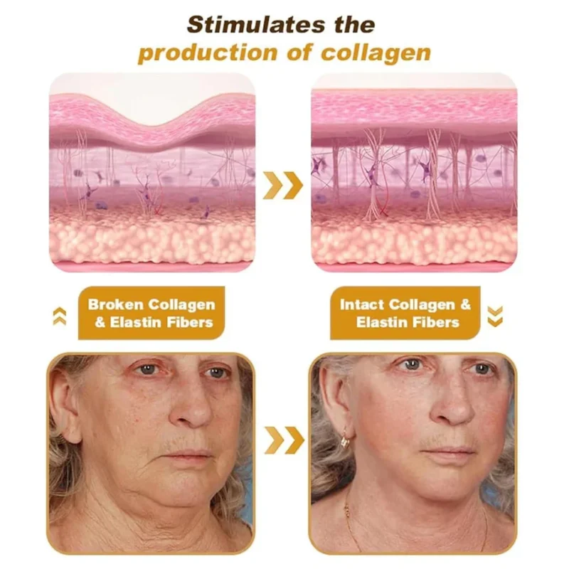 Bee Venom Wrinkle Repair Cream 🐝✨ - Image 4