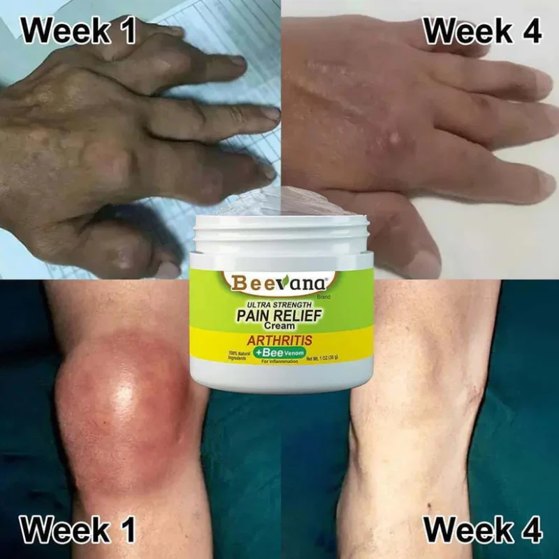 Bee-Venom Gold Pain-Relief Bone Healing Cream - Image 5